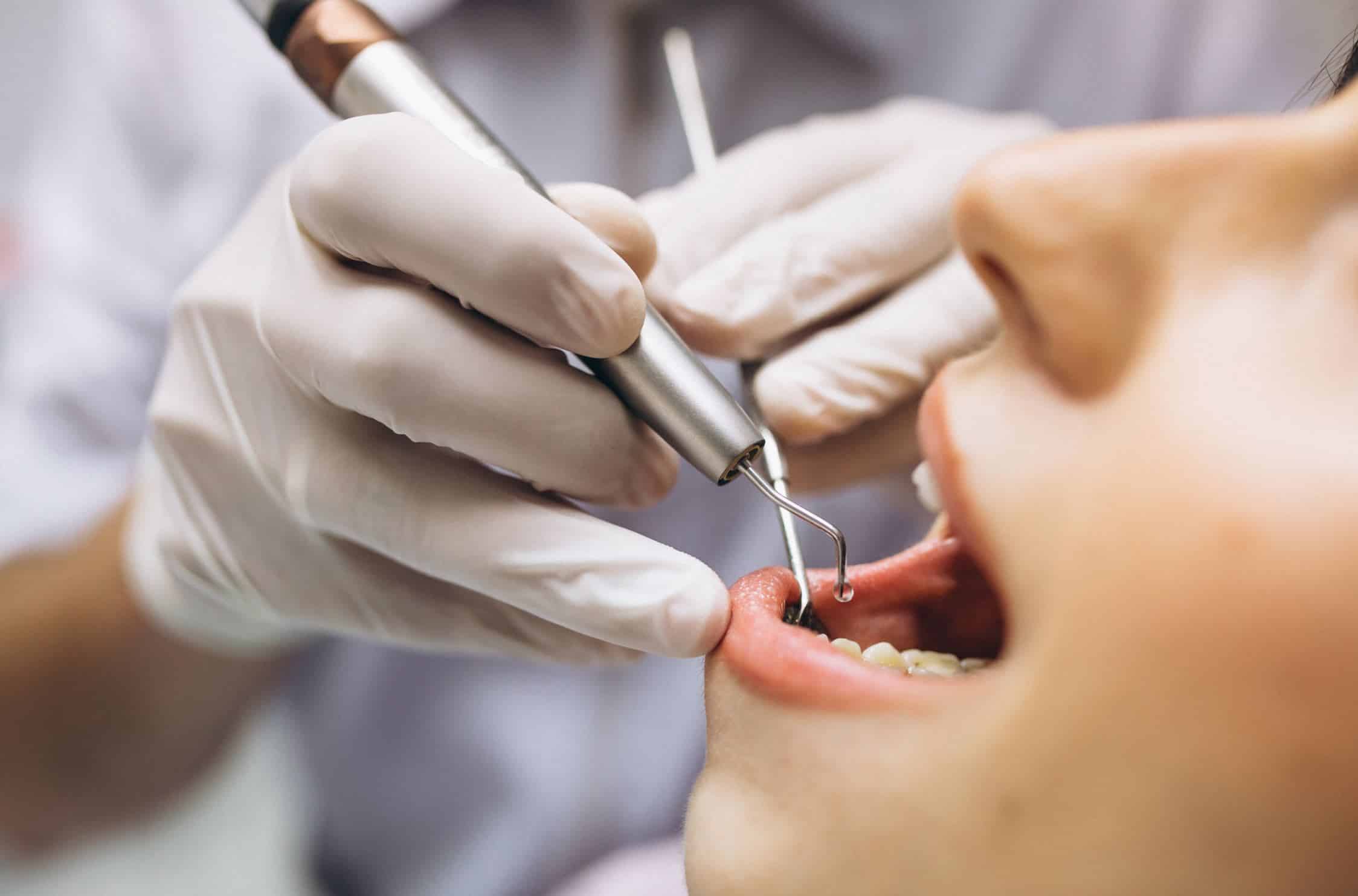 Our team of experienced dentists offer a range of periodontics services to prevent gum disease and maintain healthy gums